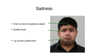 Emotion Recognition in Autism and ADHD