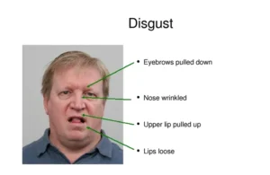 Emotion recognition in autism and ADHD